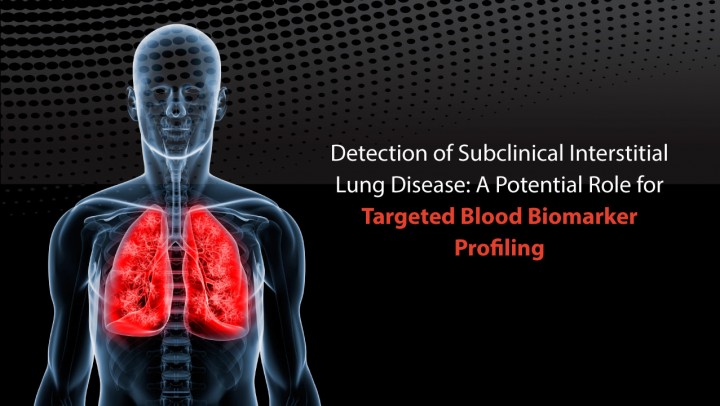 Detection of Subclinical Interstitial Lung Disease